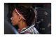 Adidas Performance Hair Scrunchies Λαστιχάκια Μαλλιών 2 Τεμάχια